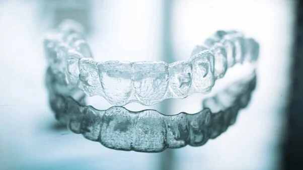 Invisalign Services -Solitaire Family Dentistry