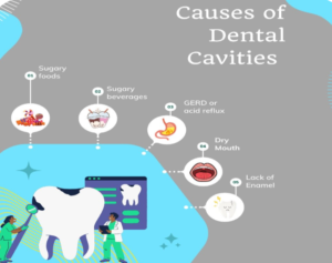 CAUSES OF TOOTH DECAY: