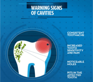 Warning Signs Of Cavities