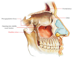 Maxillary sinuses